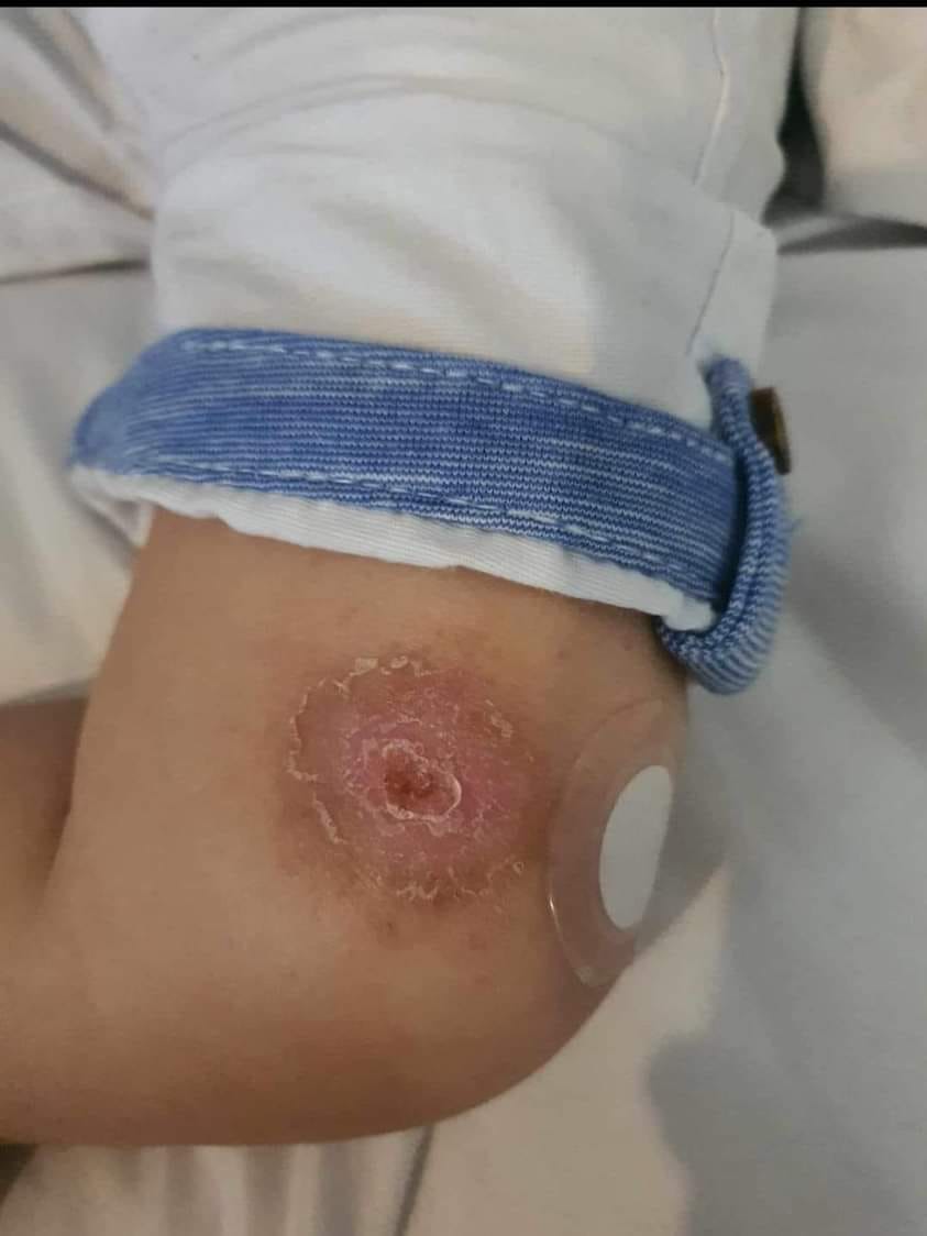 Miracolul vindecării: Cum tehnologia X39 transformă vieți